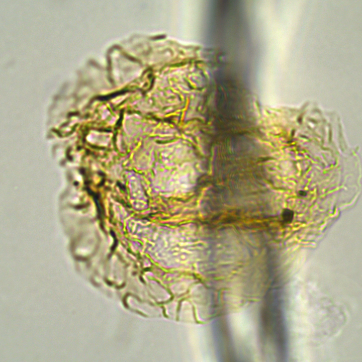 Heteraulacacysta pramparoae HprampX27390922301045 63x.jpg